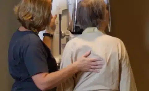 Baby Boomers and Breast Cancer: When Can I Stop Getting Mammograms?