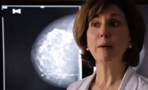 Why Your First Mammogram Should be 3D